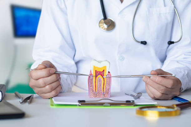 Best Knocked-Out Tooth (Avulsed Tooth) Treatment in Lake Camelot, WI